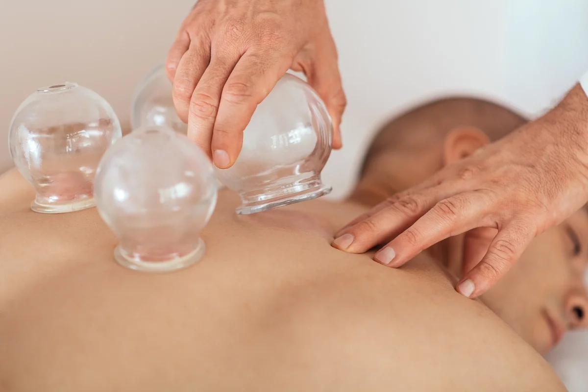 Cupping In Brooklyn - Featured